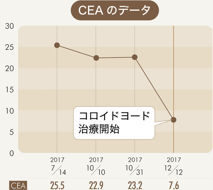 コロイドヨードグラフ